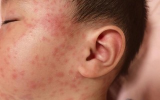 湖北疫情大爆发-湖北疫情爆发时间是几号？