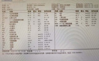 今日莫斯科疫情数据-莫斯科莫斯科莫斯科今日？