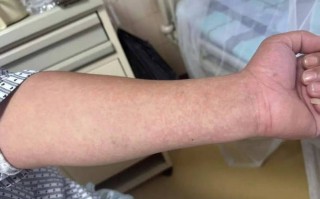 南海最新疫情通报_南海最新疫情通报数据