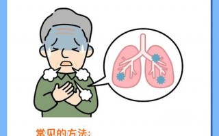 野味疫情有哪些，吃野味引起的疫情