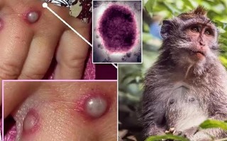 西班牙公布疫情来源_西班牙疫情是什么情况