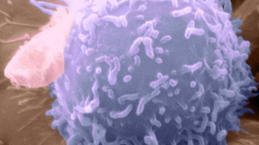 意大利疫情哪里比较多,意大利疫情严重吗 严重 但没有想象中的严重-第4张图片-德宏生活网 意大利疫情哪里比较多,意大利疫情严重吗 严重 但没有想象中的严重-第4张图片-德宏生活网