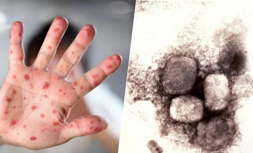 加拿大新冠疫情最新消息，加拿大新冠病毒最新情况-第6张图片-德宏生活网