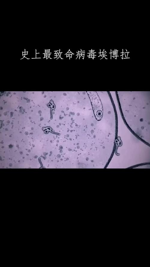 全球疫情第二大疫情国家_全球疫情第二大疫情国家排名-第3张图片-德宏生活网 全球疫情第二大疫情国家_全球疫情第二大疫情国家排名-第3张图片-德宏生活网