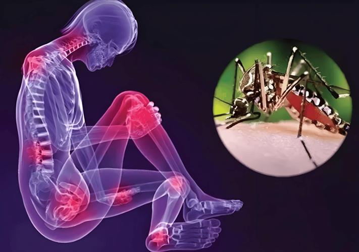 新加坡疫情今天新增，新加坡疫情今日更新-第2张图片-德宏生活网