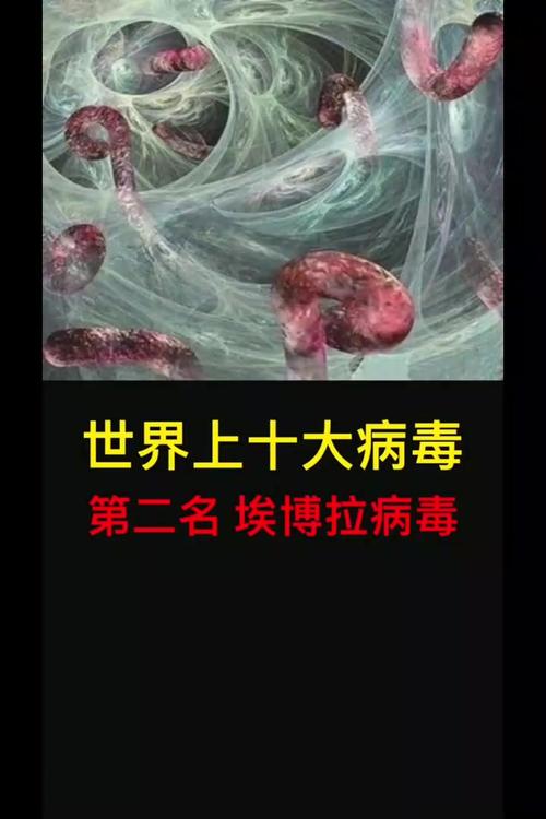 2014埃博拉疫情_2014埃博拉疫情知乎-第1张图片-德宏生活网 2014埃博拉疫情_2014埃博拉疫情知乎-第1张图片-德宏生活网