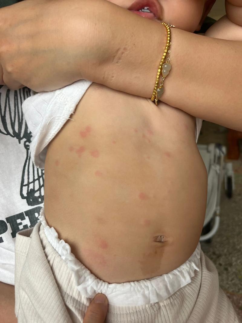 非洲津巴布韦国家疫情_非洲津巴布韦国家疫情情况-第4张图片-德宏生活网