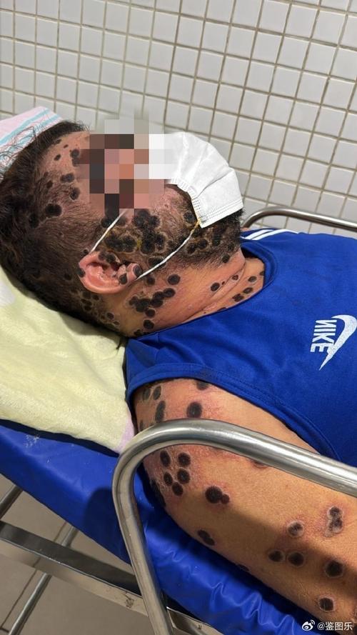 沙特近来疫情情况_沙特疫情今日最新统计-第5张图片-德宏生活网