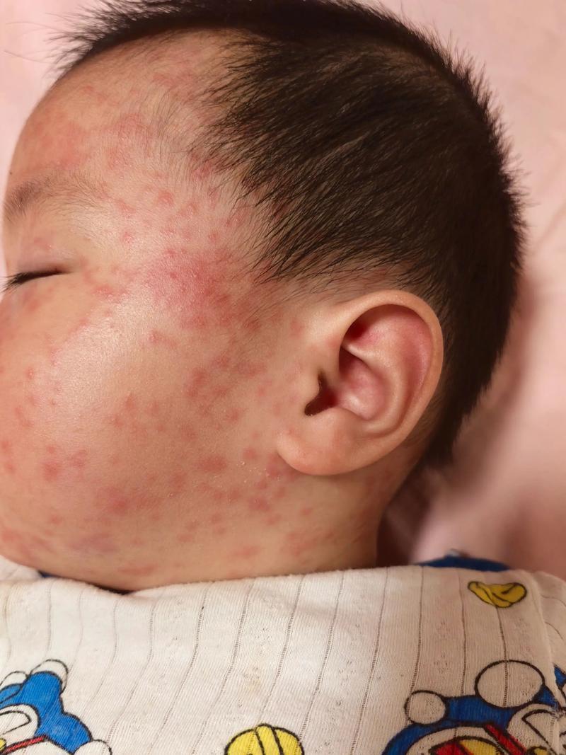 湖北疫情大爆发-湖北疫情爆发时间是几号？-第1张图片-德宏生活网