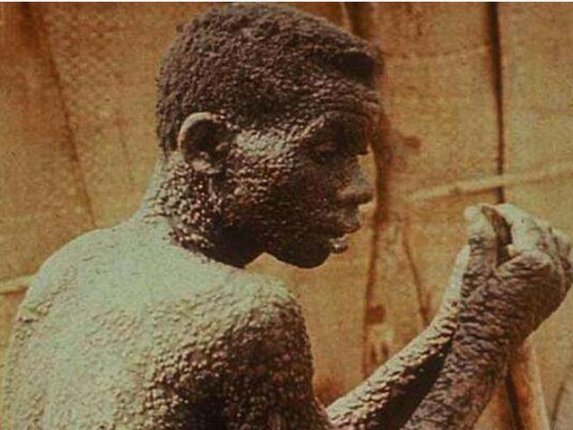 非典疫情最终情况-非典役情?-第4张图片-德宏生活网 非典疫情最终情况-非典役情?-第4张图片-德宏生活网