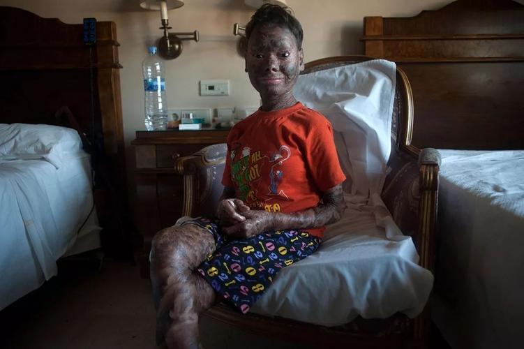 疫情对非洲经济,疫情对非洲国家的影响-第4张图片-德宏生活网 疫情对非洲经济,疫情对非洲国家的影响-第4张图片-德宏生活网