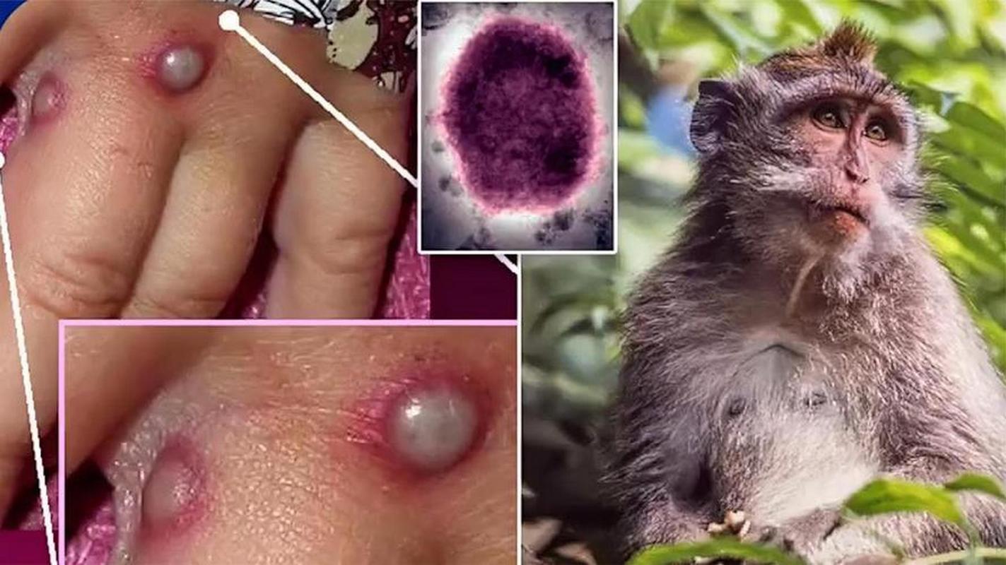 西班牙公布疫情来源_西班牙疫情是什么情况-第1张图片-德宏生活网 西班牙公布疫情来源_西班牙疫情是什么情况-第1张图片-德宏生活网