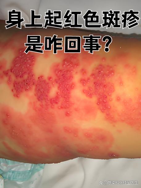 咸宁10日疫情，咸宁今天新增疫情-第5张图片-德宏生活网