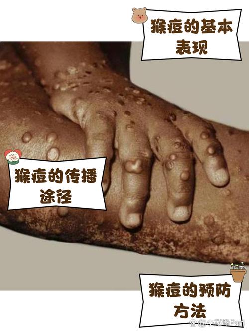 疫情的感染过程-疫情的感染过程怎么写？-第2张图片-德宏生活网