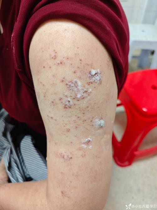 介绍疫情的情况-疫情,介绍？-第5张图片-德宏生活网