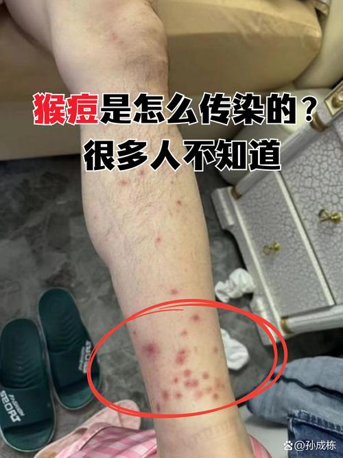 喀麦隆新冠疫情_2021年喀麦隆疫情严重吗-第3张图片-德宏生活网