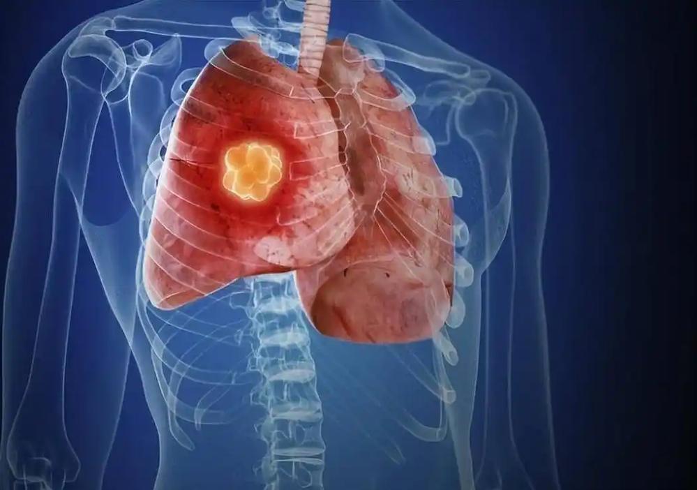 关于疫情源头的-疫情的源头作文？-第1张图片-德宏生活网