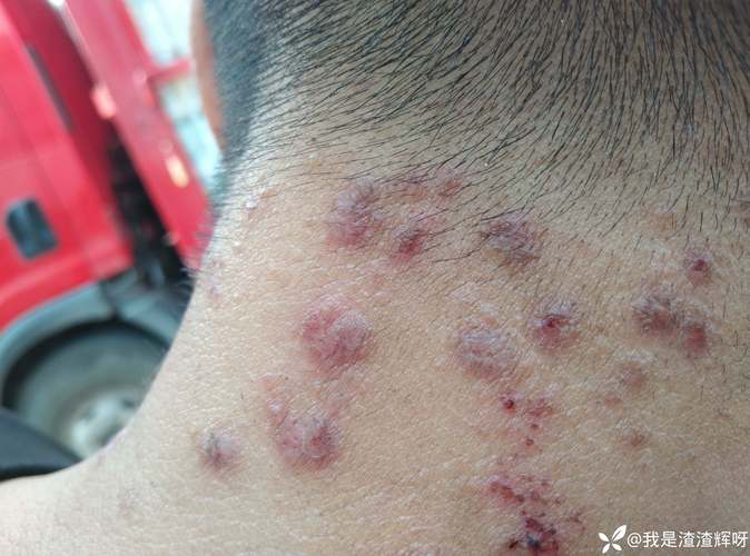 徐州疫情17号_徐州疫情实况-第4张图片-德宏生活网