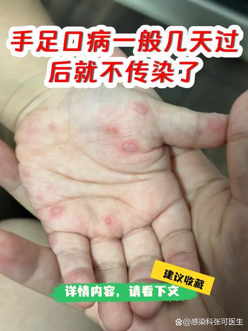 西安疫情隔离酒店-西安防疫隔离酒店?-第5张图片-德宏生活网 西安疫情隔离酒店-西安防疫隔离酒店?-第5张图片-德宏生活网