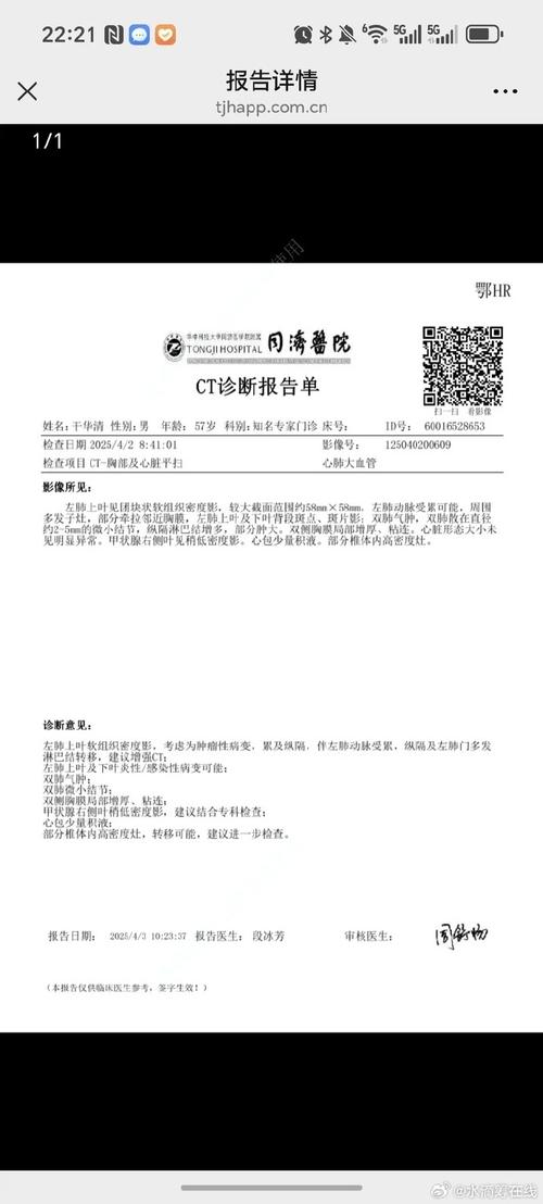 西双版纳肺炎疫情，西双版纳疫情通告-第3张图片-德宏生活网