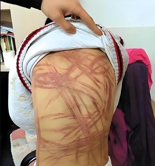 成都疫情保安工作，疫情期间保安工作人员职责-第3张图片-德宏生活网