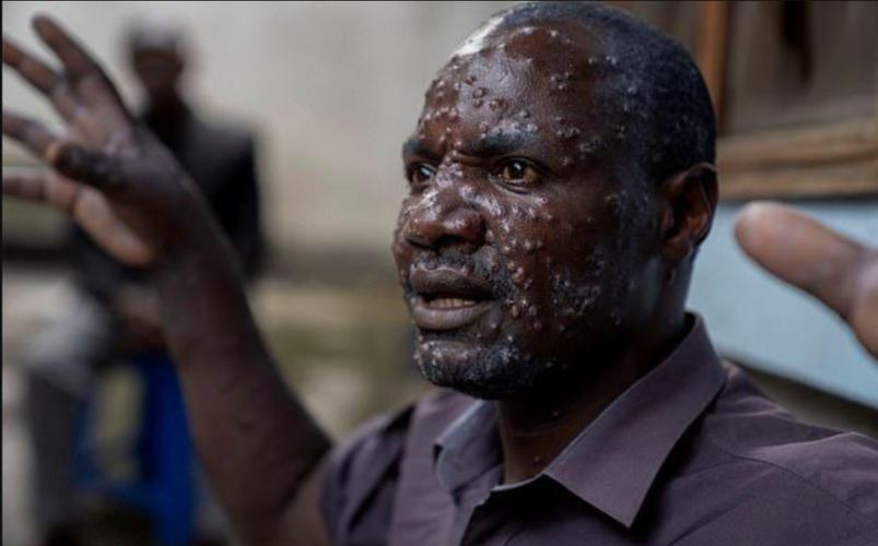 如何定性疫情国，什么是疫情国-第5张图片-德宏生活网