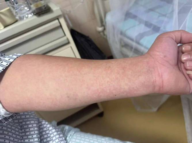 南海最新疫情通报_南海最新疫情通报数据-第1张图片-德宏生活网