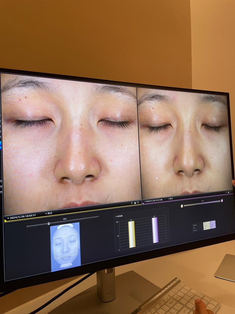 疫情还未爆发前,疫情不会爆发-第3张图片-德宏生活网 疫情还未爆发前,疫情不会爆发-第3张图片-德宏生活网