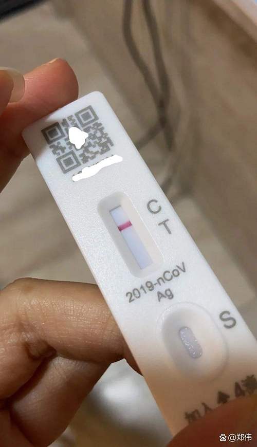 疫情检测要多久-疫情检测多少钱一次？-第5张图片-德宏生活网