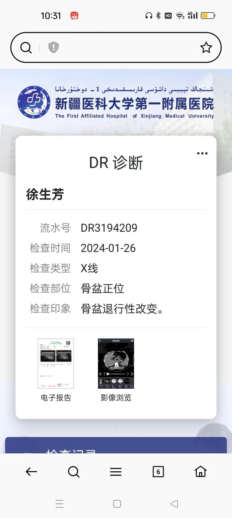 乌鲁木齐疫情几号-乌鲁木齐关于疫情最新通知几点更新？-第2张图片-德宏生活网