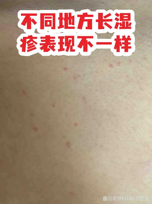 广东举报疫情奖励，广州疫情防控举报有奖吗-第5张图片-德宏生活网